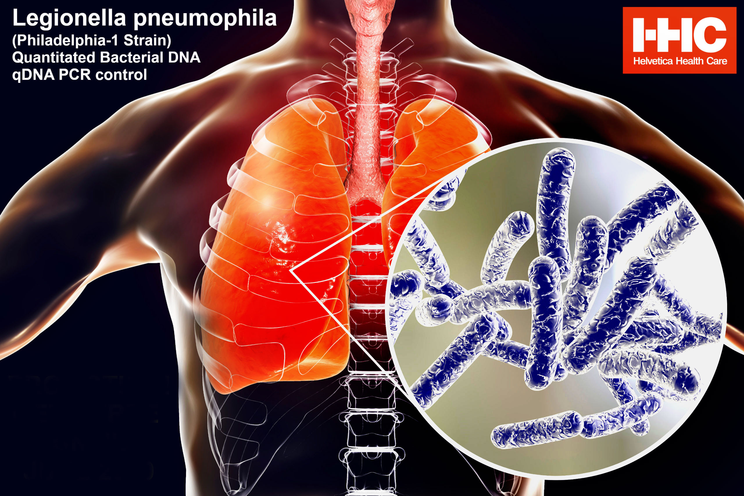 Hình dạng Legionella pneumophila và sống trong phổi